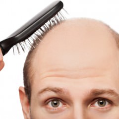 植毛した毛が抜ける…自毛植毛でも髪が抜ける原因とは？