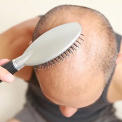 髪が抜ける原因や症状と正しい対処法