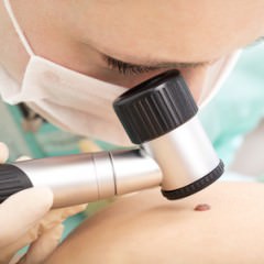 頭皮が火傷をしたときの対処法