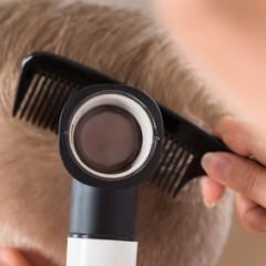 オイリーヘアの人は脂性フケに注意するべきなの？