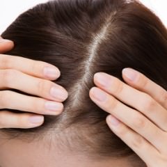 赤い頭皮の原因と正しい治療方法 知らなきゃ損 正しいヘアケア講座