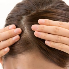 オイリーヘアの人は脂性フケに注意するべきなの？