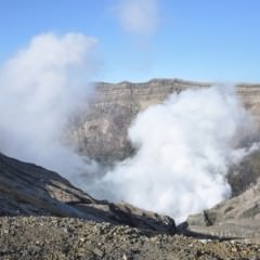 円形脱毛症、液体窒素での治療は効果なし？