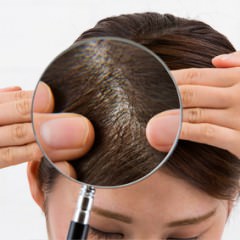 女性の薄毛の原因とは？種類別の健康的な薄毛対策と予防法
