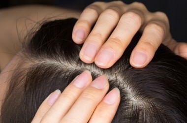 頭皮の炎症…皮膚科に行くべきサインは？　ヘアケア講座　頭皮ケア（スカルプケア）