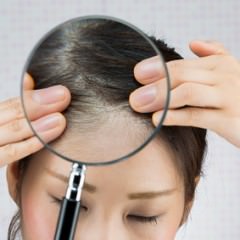 オイリーヘアの人は脂性フケに注意するべきなの？