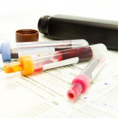 簡単に薄毛を隠せる増毛パウダーの仕組みとは？使い方や注意点もご紹介！