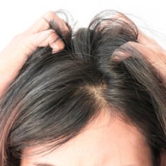 オイリーヘアの人は脂性フケに注意するべきなの？