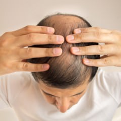 薄毛になりにくい髪型やヘアスタイルってあるの？