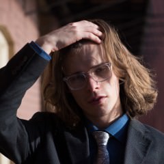 目の下にクマがある人は薄毛になるの？