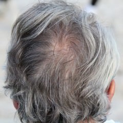薄毛改善に効果アリ！「ラジオ波」が髪の成長を促す！