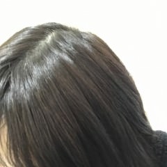 季節に合わせたヘアケアで乱れたヘアサイクルを正常化しましょう