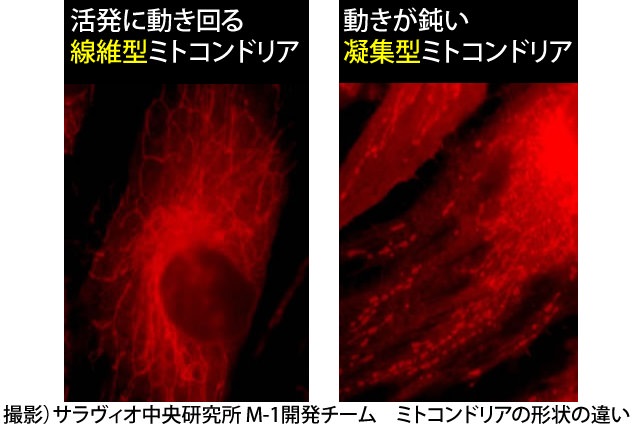 【博士監修の育毛講座】ミトコンドリアが弱ると髪もヘタる！育毛の新常識3