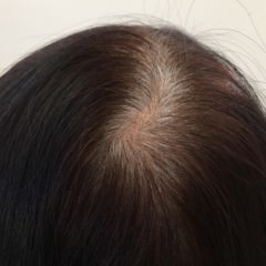 白髪予防に効くヘアオイルとは