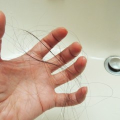 血行促進ガスを頭皮に注入する薄毛治療とは