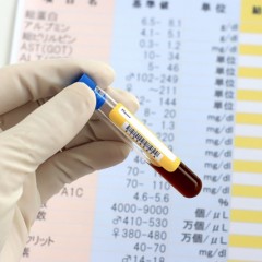 女性の抜け毛・薄毛には”女性用”育毛剤を使うべき