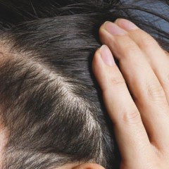 髪が抜ける原因や症状と正しい対処法