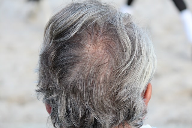 白髪が生えるのは色々な要因の積み重ね！具体的な原因をご紹介します