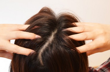 加齢による薄毛と普通の薄毛の原因と予防法は違う？