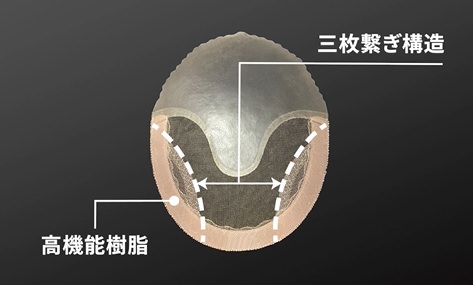 アートネイチャーの値段や料金はいくら？毎月の費用と増毛やかつらの価格を徹底調査しました！11