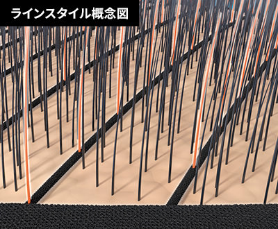 【最新版】スヴェンソンの増毛の評判や口コミは？気になる価格や特徴などを徹底解説13