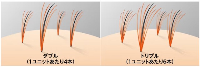 スヴェンソンの価格や料金体系は？かつらの値段や増毛の費用などを徹底調査しました！11