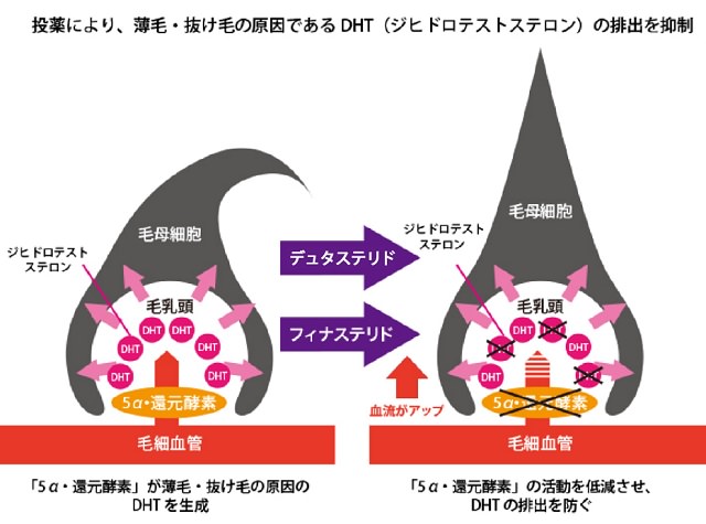 【最新】駅前AGAクリニックの口コミや評判は？料金や効果まで徹底解説6