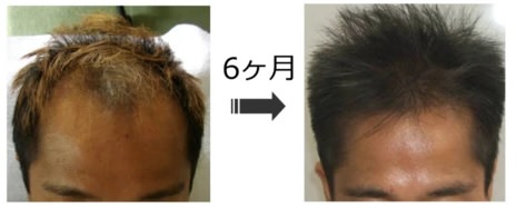 静岡・浜松の育毛サロン26