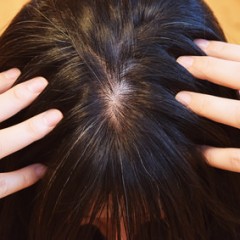 頭皮のかゆみは白髪が生える前兆？