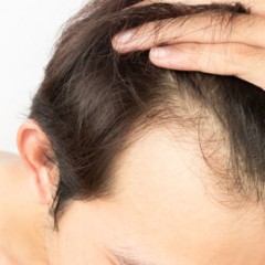 フケの種類や特徴は？種類別の解決方法をご紹介！