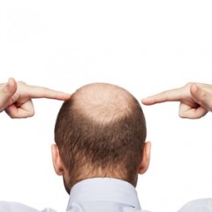 ファスティングで薄毛・抜け毛が改善？