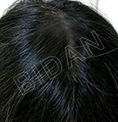 BIDAN（ビダン） 梅田店のギャラリー画像03