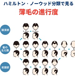 AGAオンラインクリニック≪無料カウンセリングはこちら≫のギャラリー画像01