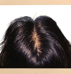 アクティヘアLabo/ACTI HAIR CLINICのギャラリー画像04